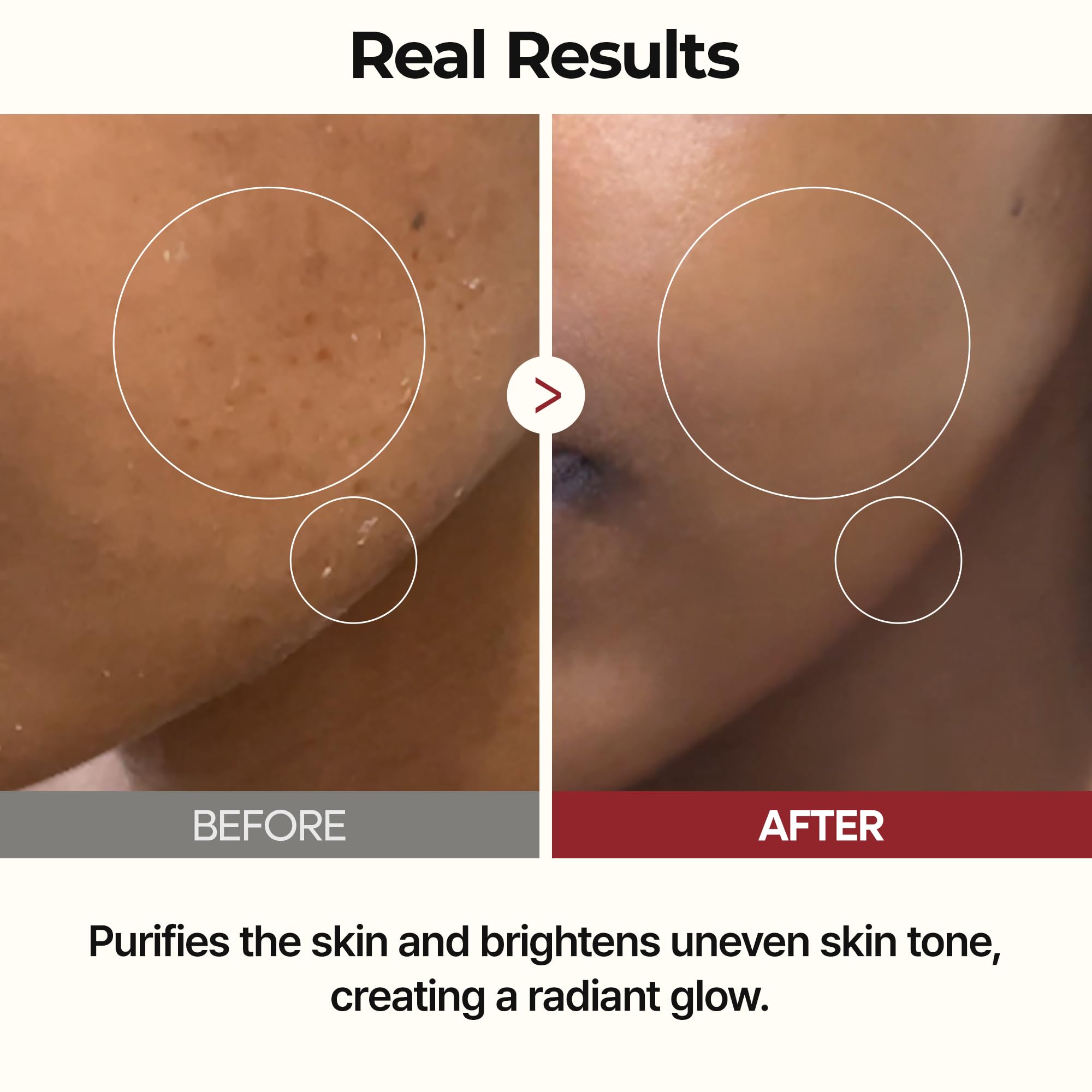 Pouring Dr.Melaxin Peel Shot Glow Rice Toner ensures even, gentle distribution.
