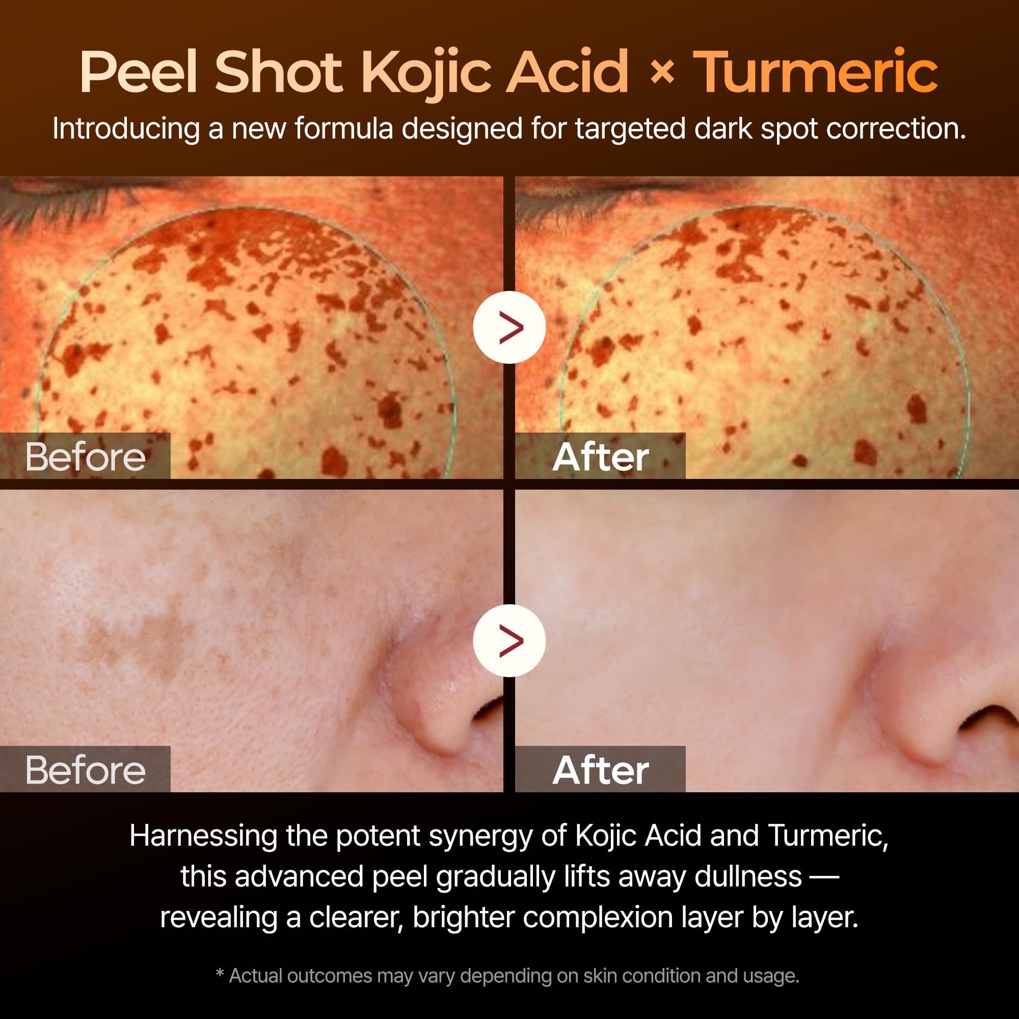 Close-up of kojic acid ingredient in Dr. Melaxin Peel Shot
