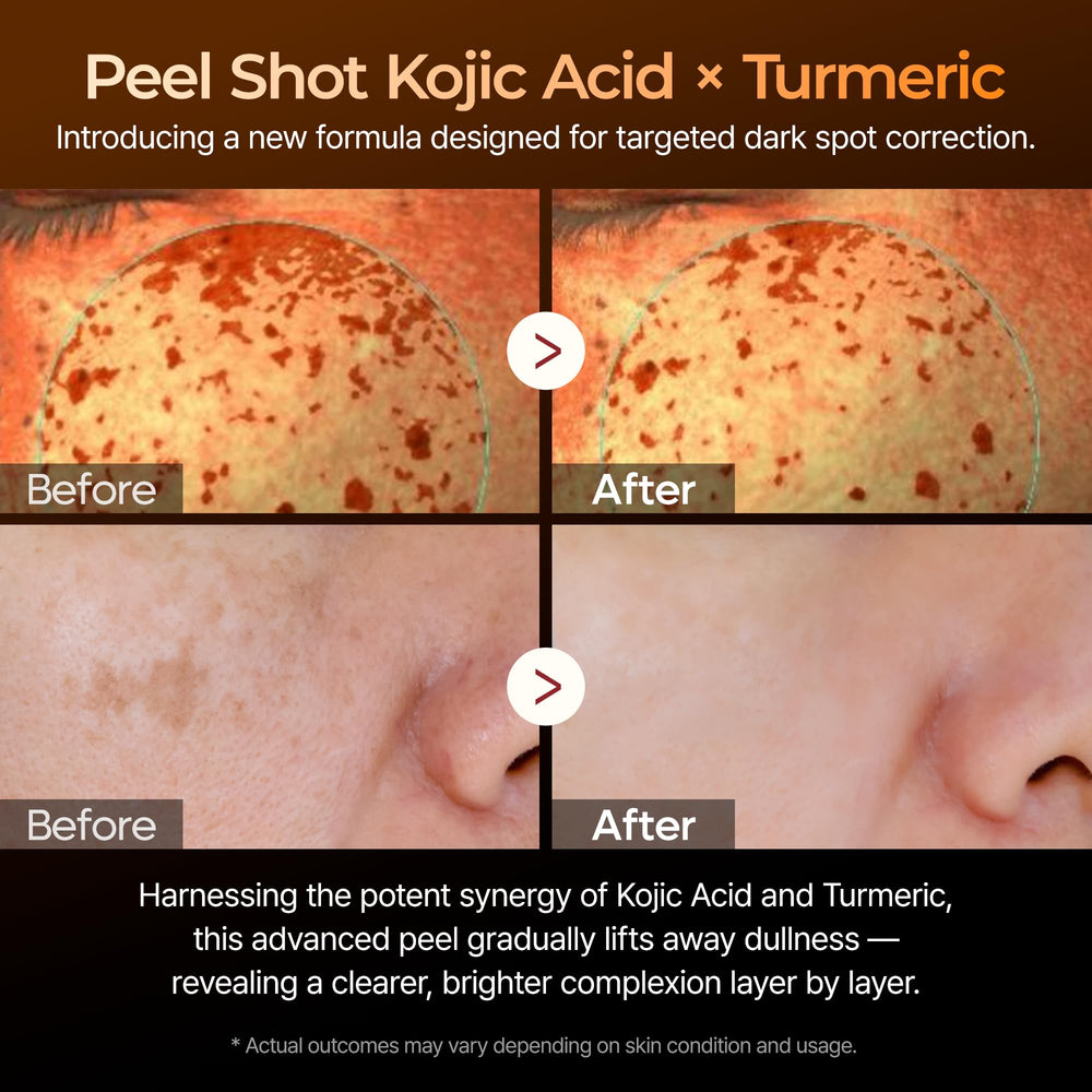 Close-up of kojic acid ingredient in Dr. Melaxin Peel Shot