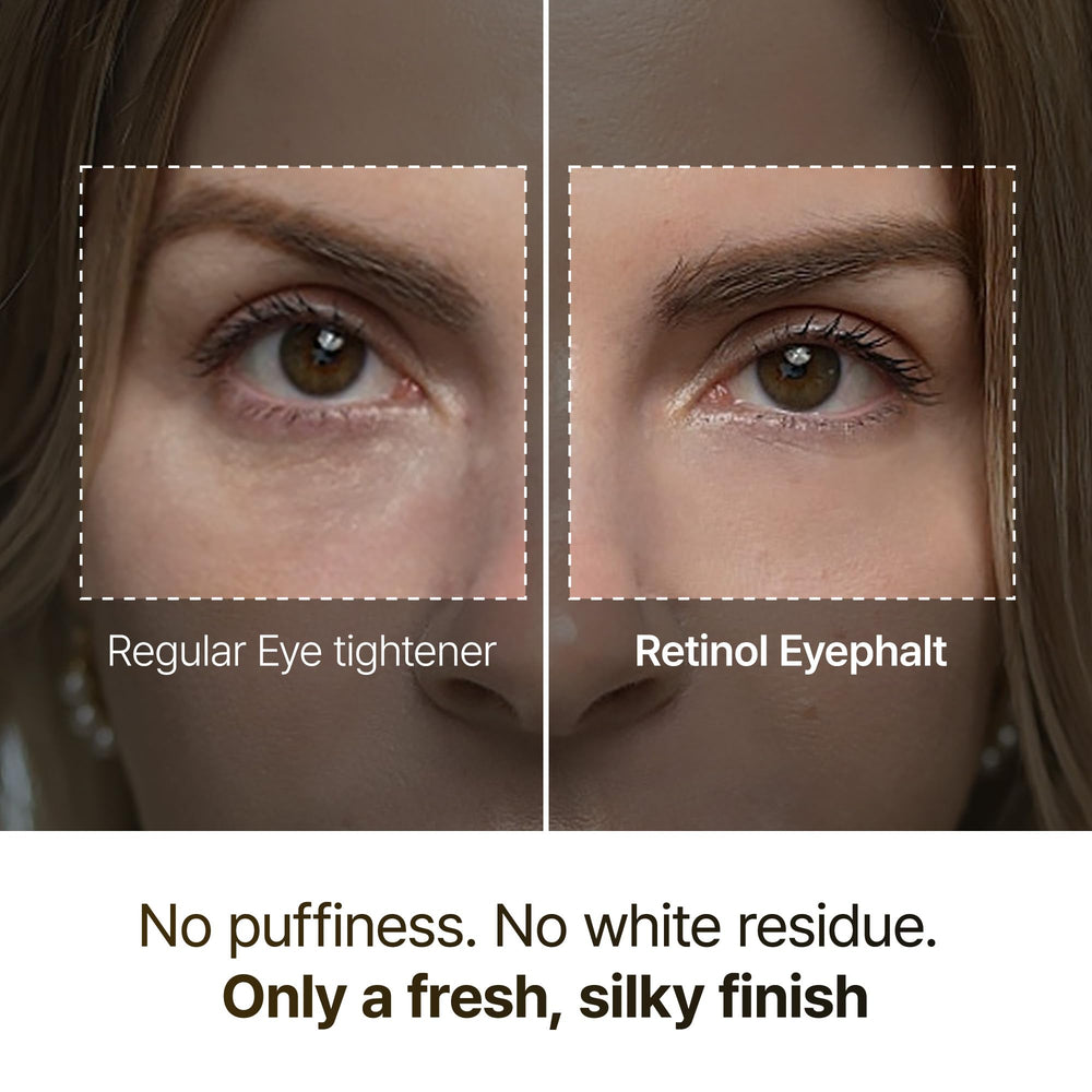 Dr.Melaxin Retinol Eyebag Cream texture closeup highlights silky formula ideal for delicate skin.