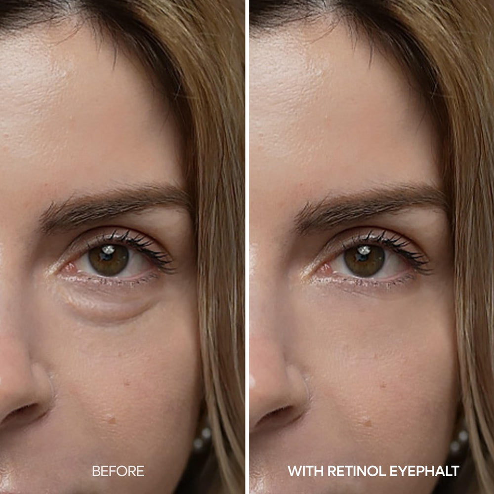 Dr.Melaxin Retinol Eyebag Cream under-eye application shows smooth spread without tugging.