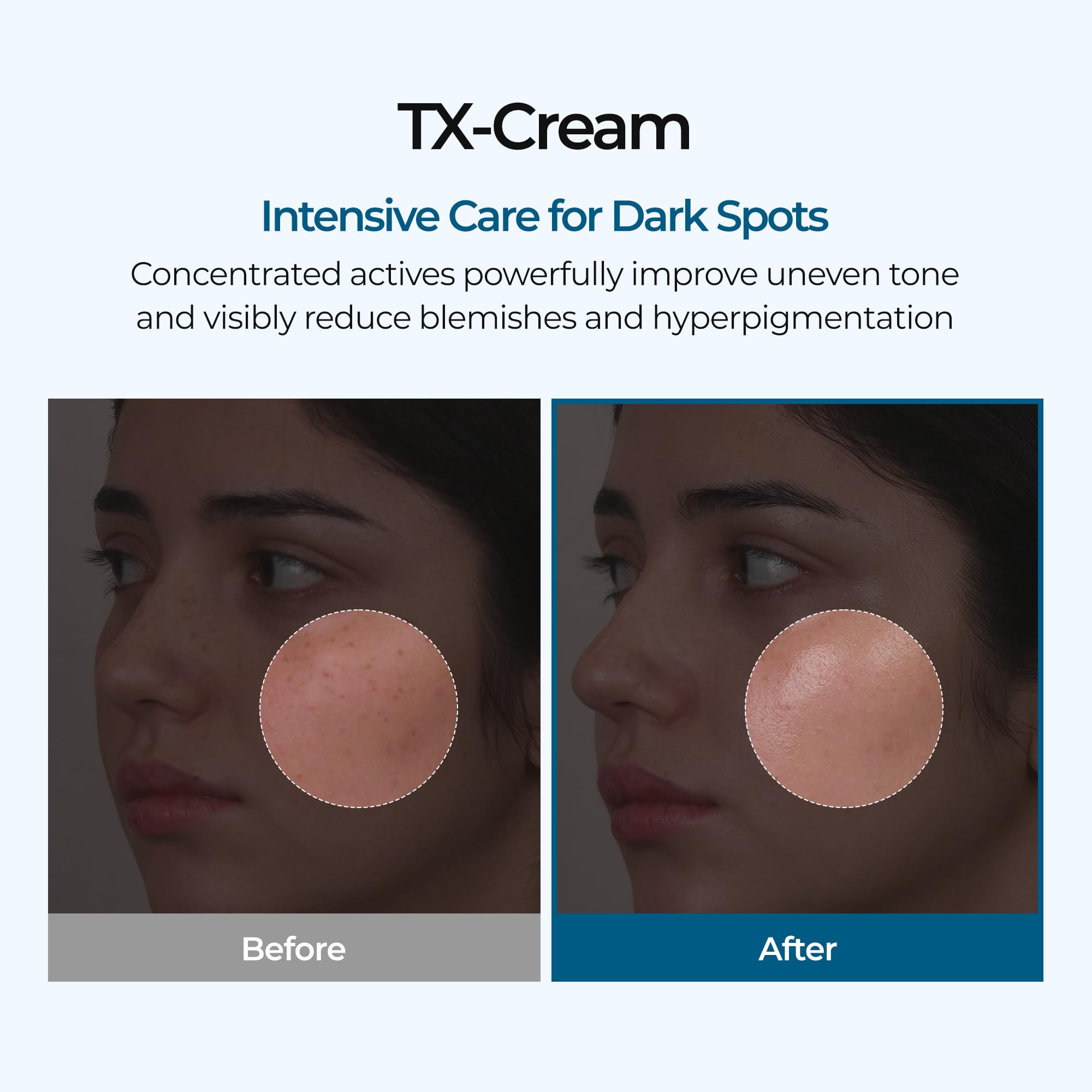 Dr.Melaxin TX Cream texture close-up suggests creamy hydration for balanced skin.