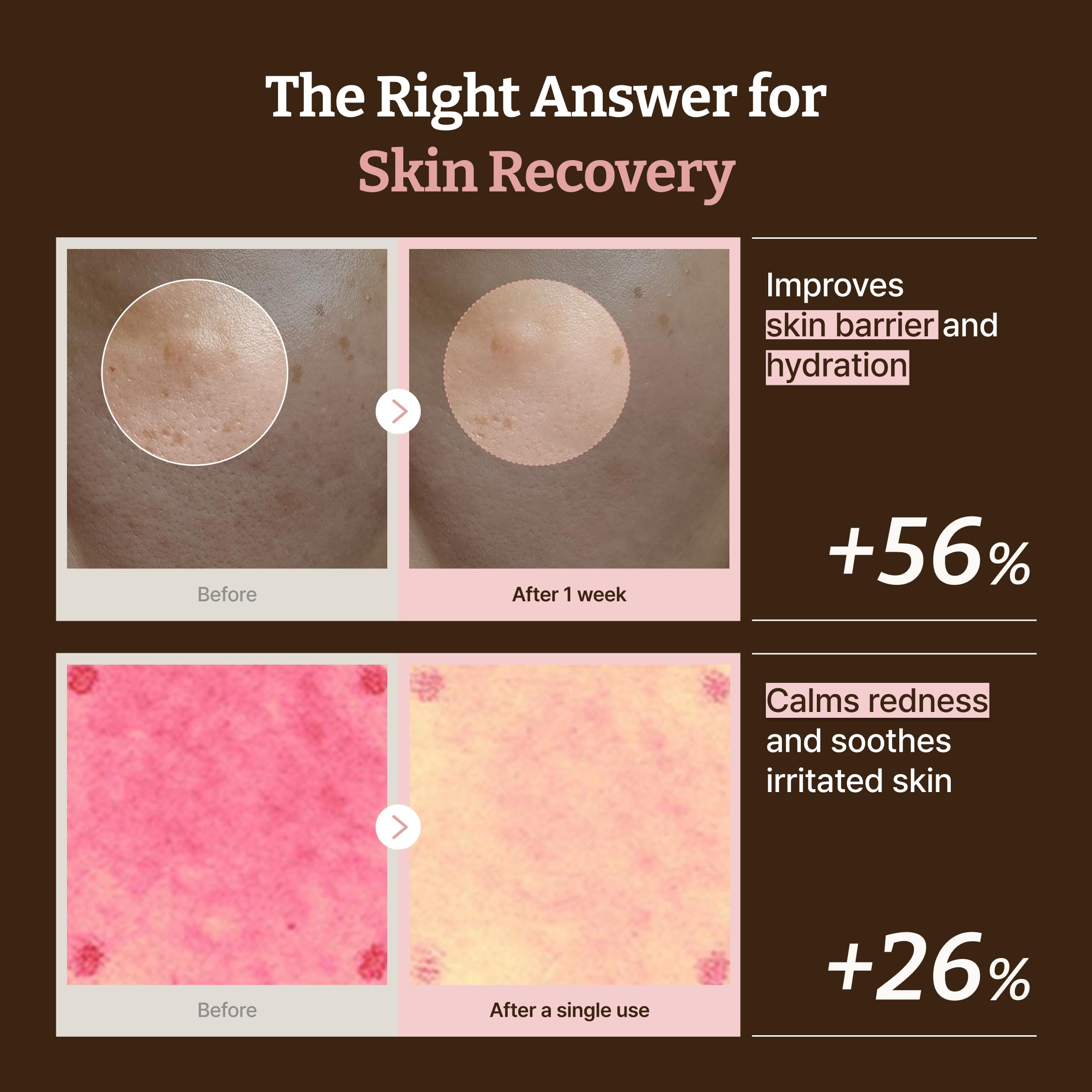Gel-like texture of Dr.Reju-All PDRN cream being applied to skin