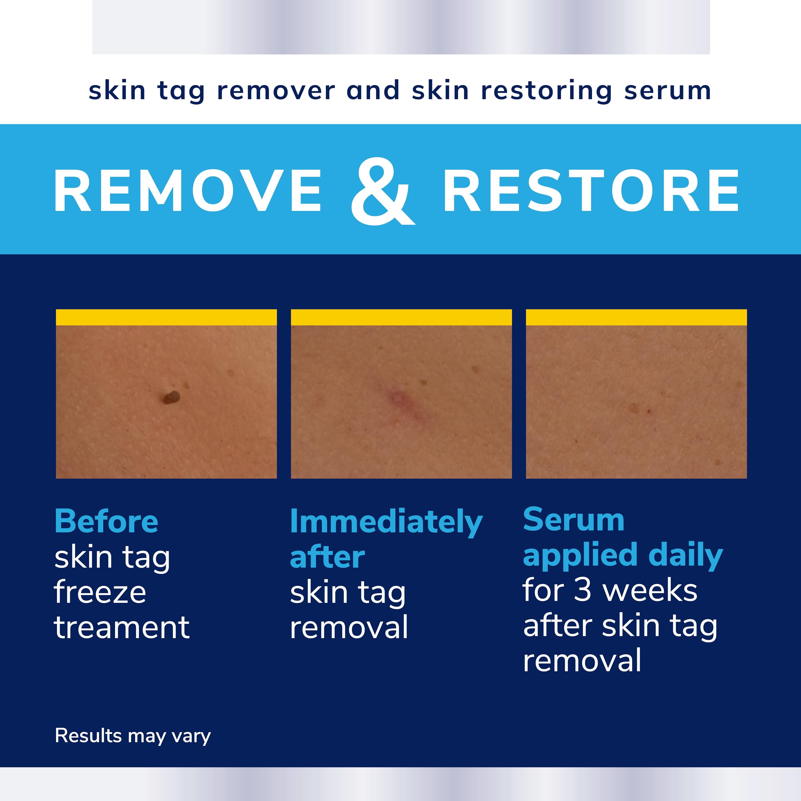 Dr. Scholl's Complete Care front packaging showing home treatment branding
