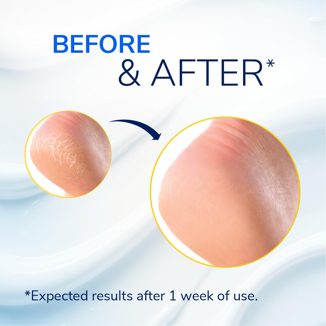 Dr. Scholl's Severe Cracked Heel Repair Balm packaging on shelf for easy purchase