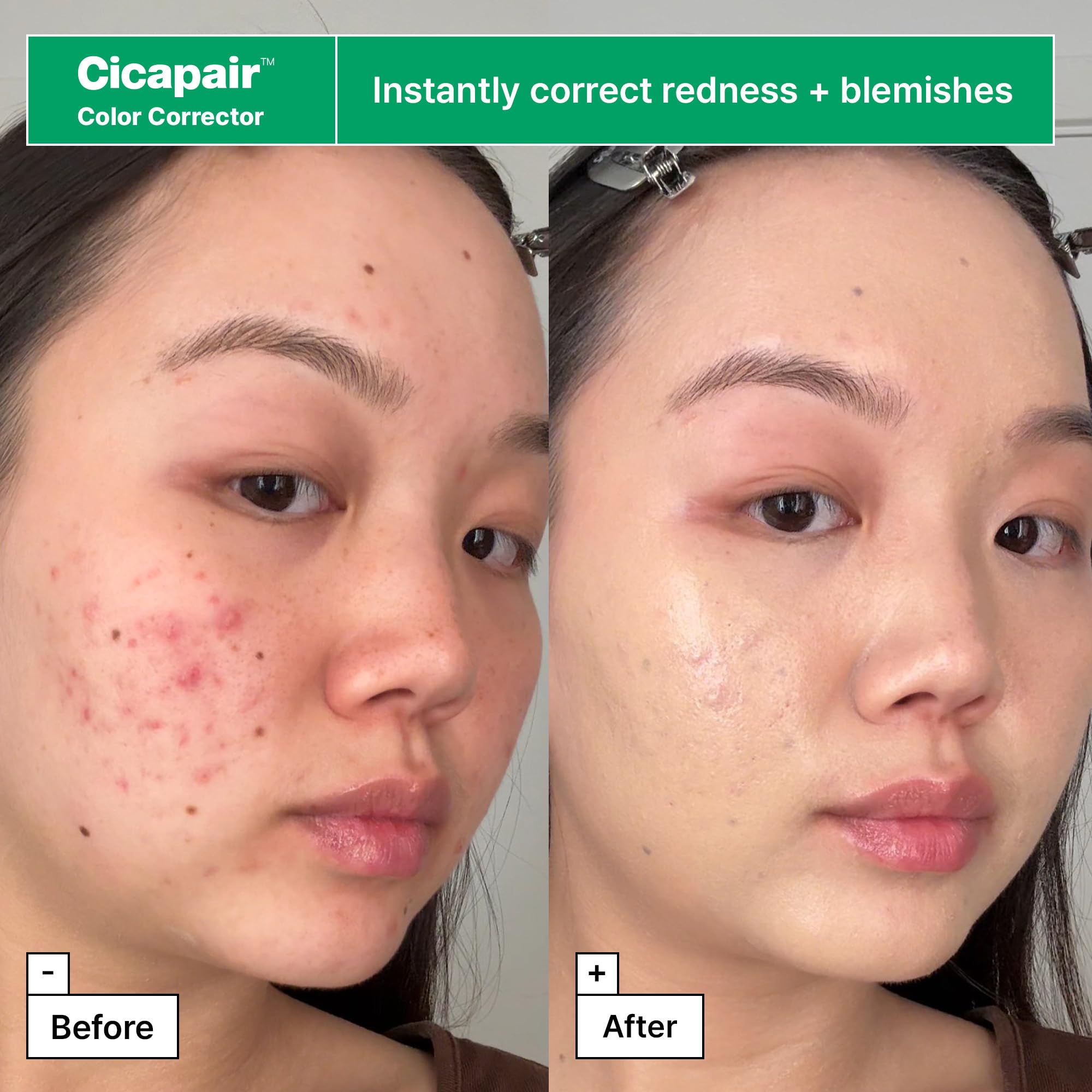 Dr.Jart+ Cicapair barrier serum bottle highlighting barrier repair benefits.