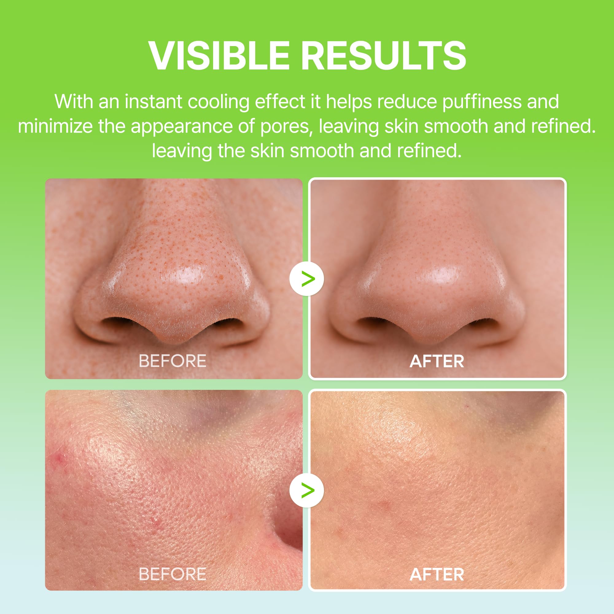 Dr.Melaxin Cactox Pore Relief visual of reduced pore visibility.