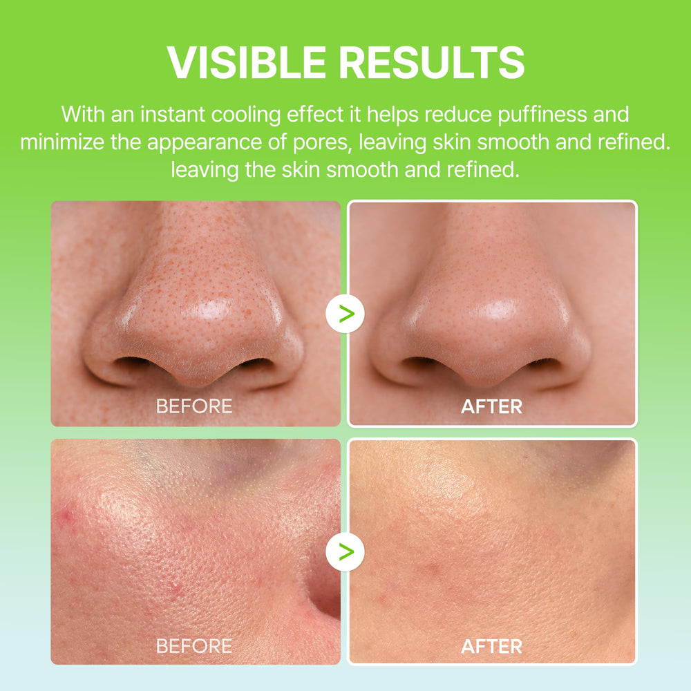 Dr.Melaxin Cactox Pore Relief visual of reduced pore visibility.