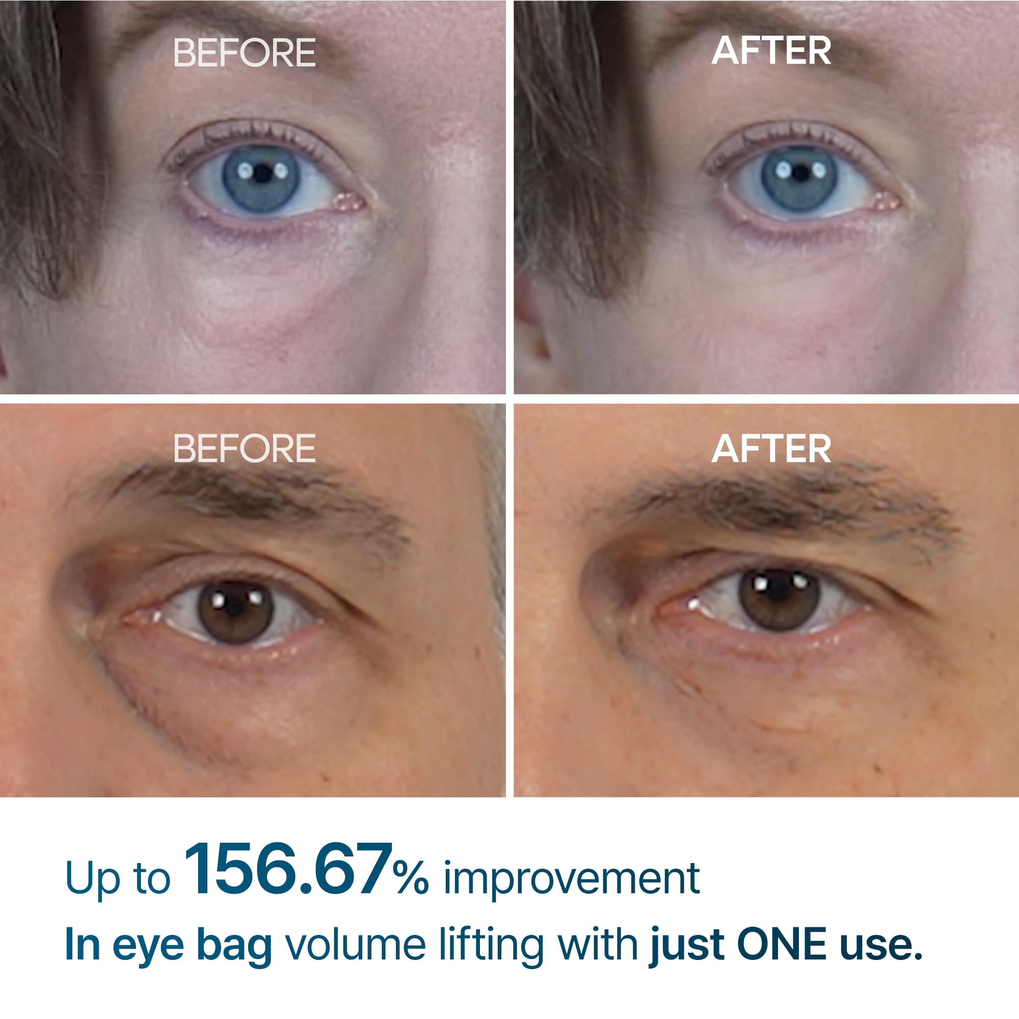 Dr.Melaxin Eyephalt Eyebag Cream swatch shown on skin texture.