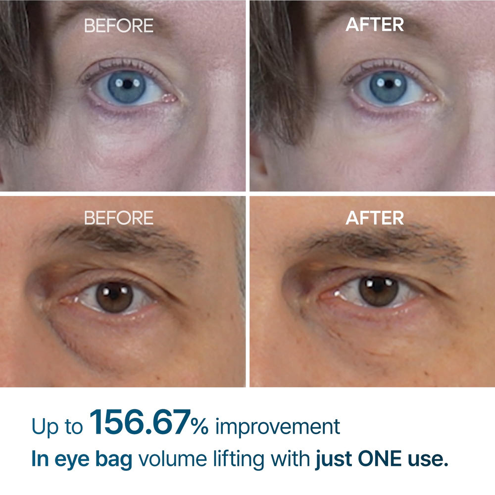 Dr.Melaxin Eyephalt Eyebag Cream swatch shown on skin texture.
