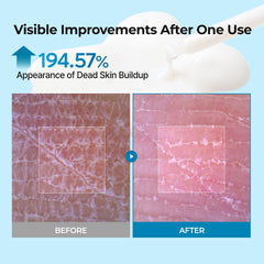 Dr.Melaxin TX Peel Shot texture close-up reveals creamy serum ideal for smoothing.