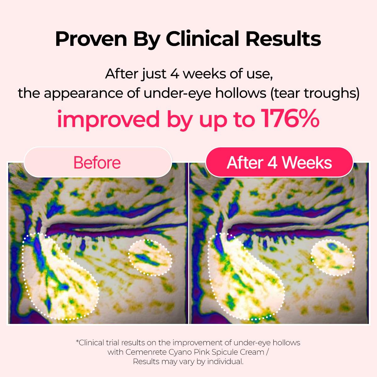Dr.Melaxin under-eye application – creamy eye cream being gently patted into the skin.
