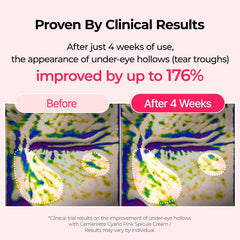 Dr.Melaxin under-eye application – creamy eye cream being gently patted into the skin.
