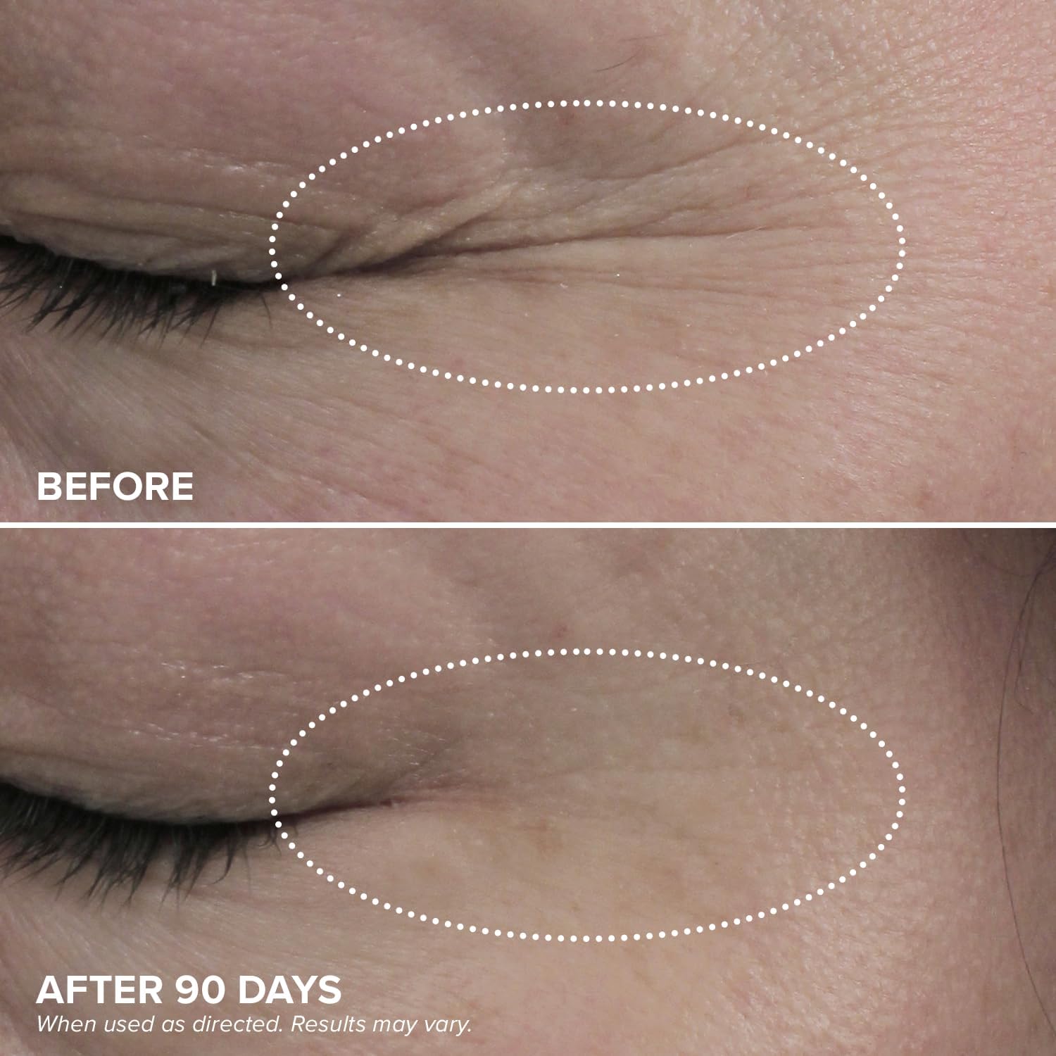 Application shot of DRMTLGY HPR Eye Cream on the under eye area