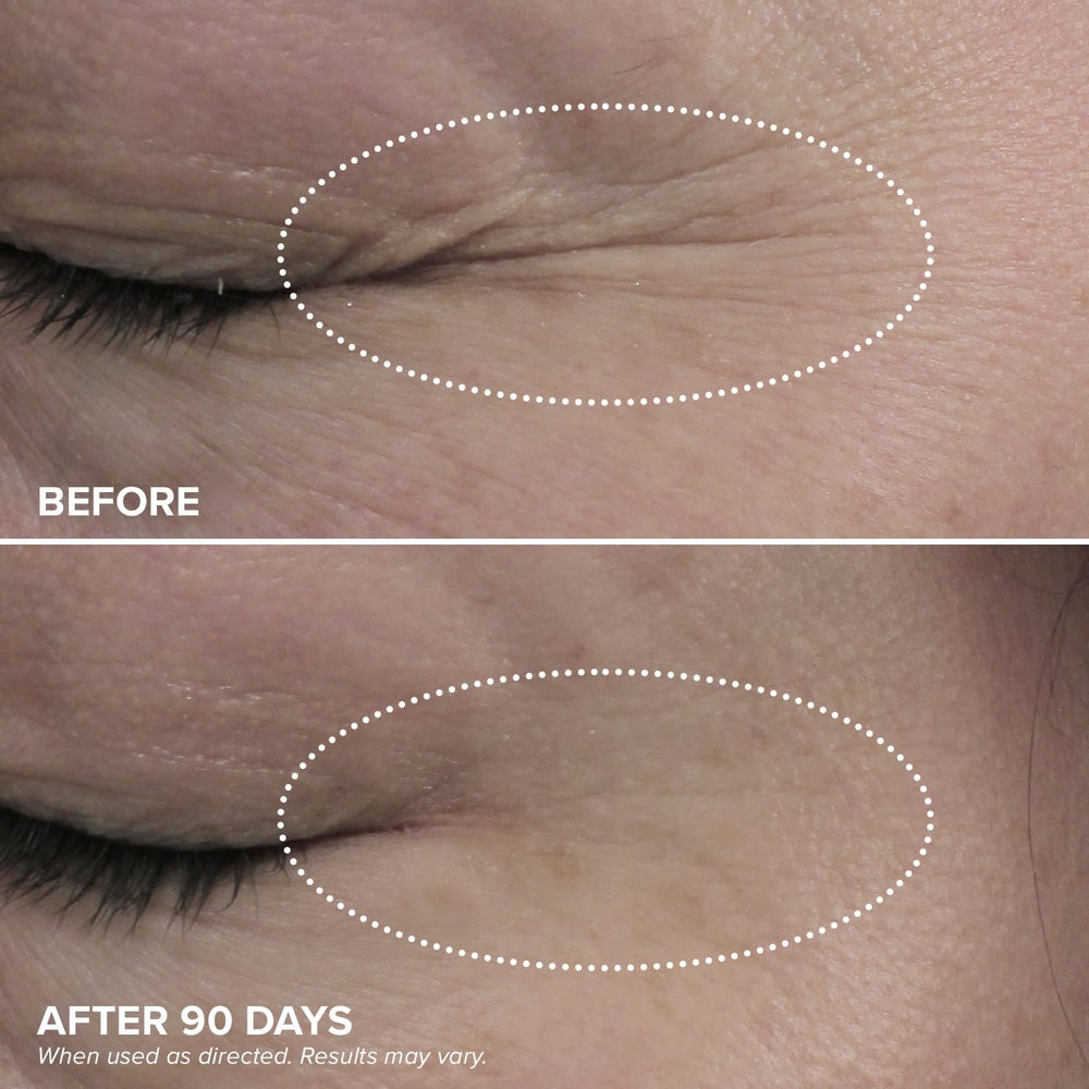 Application shot of DRMTLGY HPR Eye Cream on the under eye area
