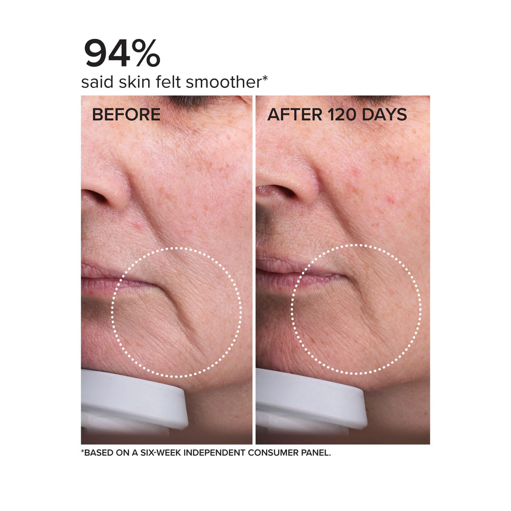 DRMTLGY Needle-less Serum hyaluronic acid visualization emphasizes hydration and plumpness