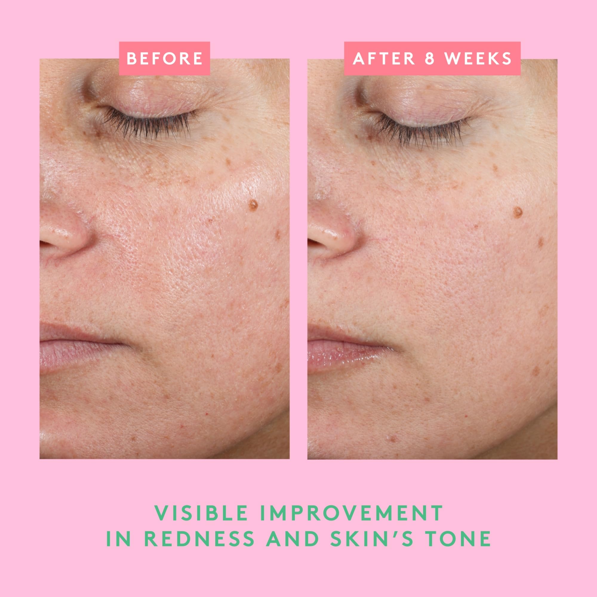 Daily-use scene implies barrier support for dry, compromised skin