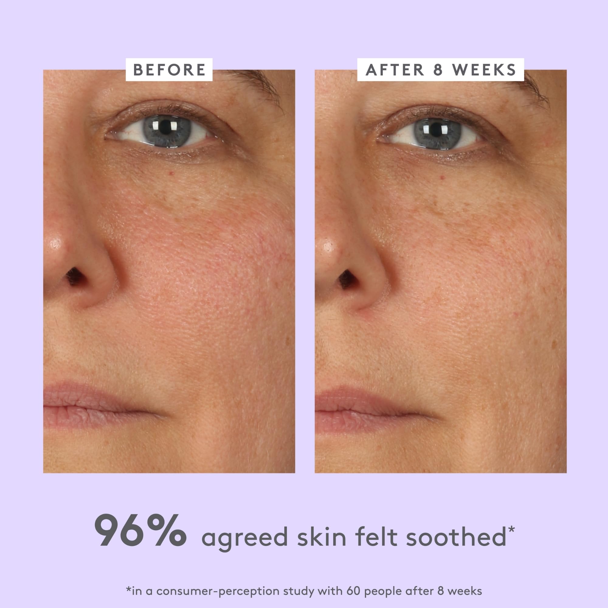 Aplicación de Lala Retro por la mañana y noche en rostro limpio