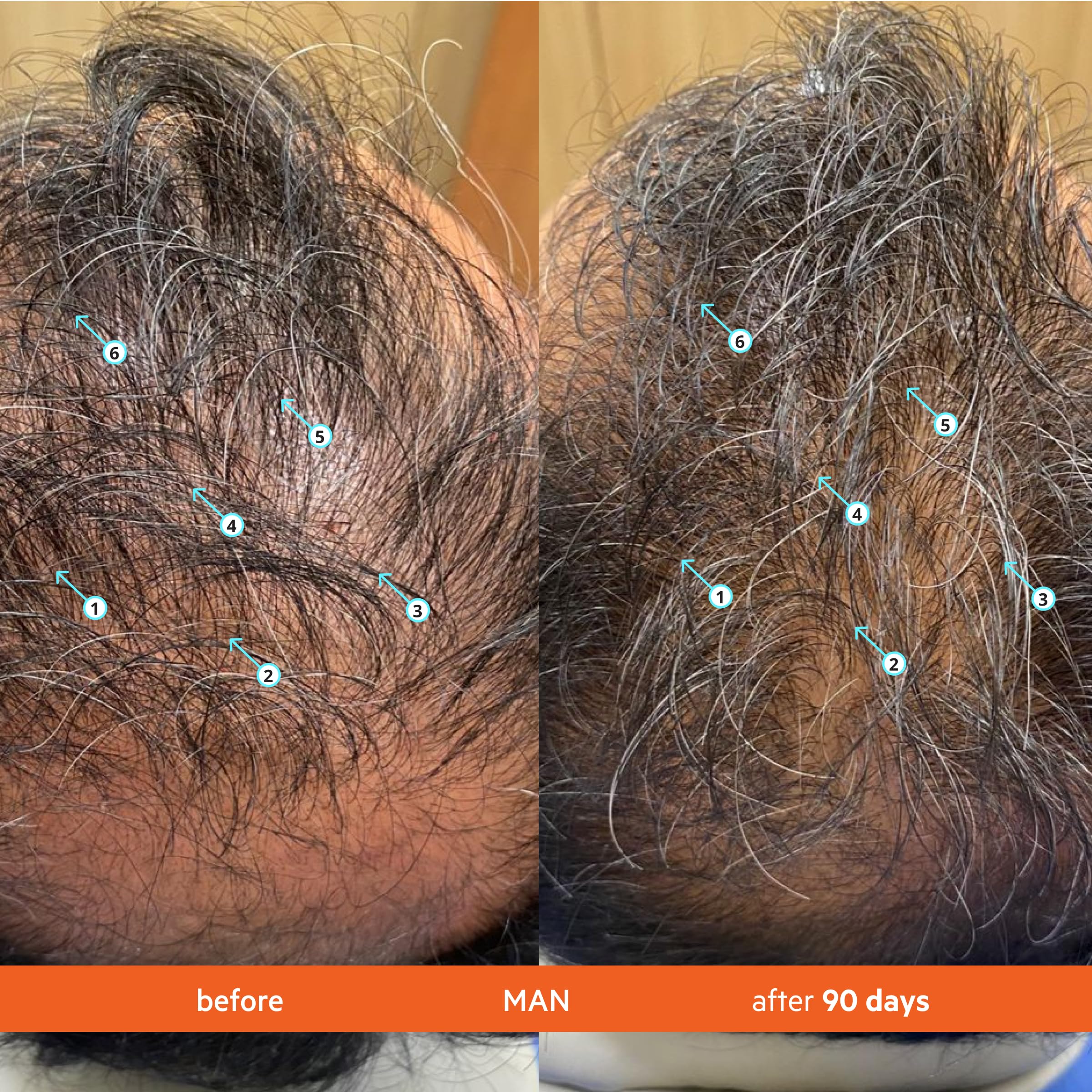 DS Laboratories Revita scalp-care close-up highlights caffeine and biotin for vitality.