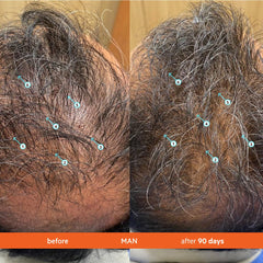 DS Laboratories Revita Shampoo ingredients closeup emphasizes caffeine and biotin for scalp vitality.