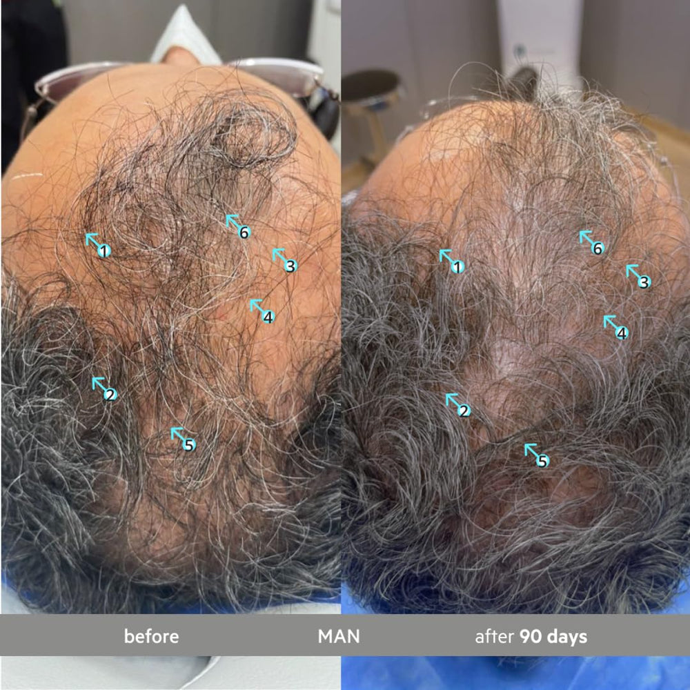 DS Labs Spectral Extra Strength Serum applied on scalp during routine haircare.