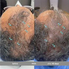 DS Labs Spectral Extra Strength Serum applied on scalp during routine haircare.