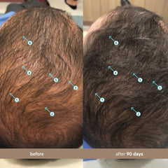 DS Laboratories Spectral Men’s density serum on scalp showcases fuller appearance during daily routine
