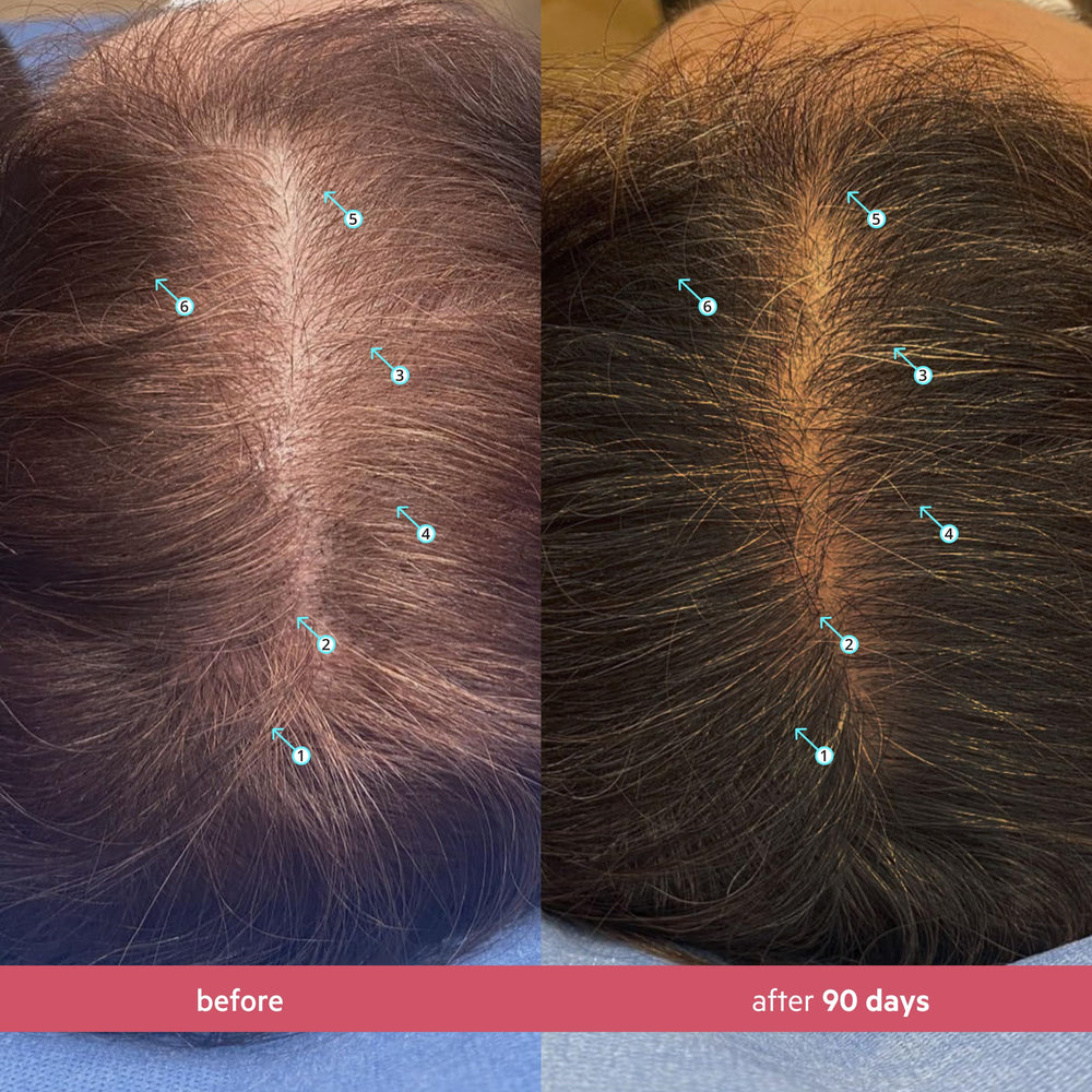 DS Laboratories Spectral Women’s Serum on scalp during daily routine.