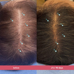 DS Laboratories Spectral Women’s Serum on scalp during daily routine.