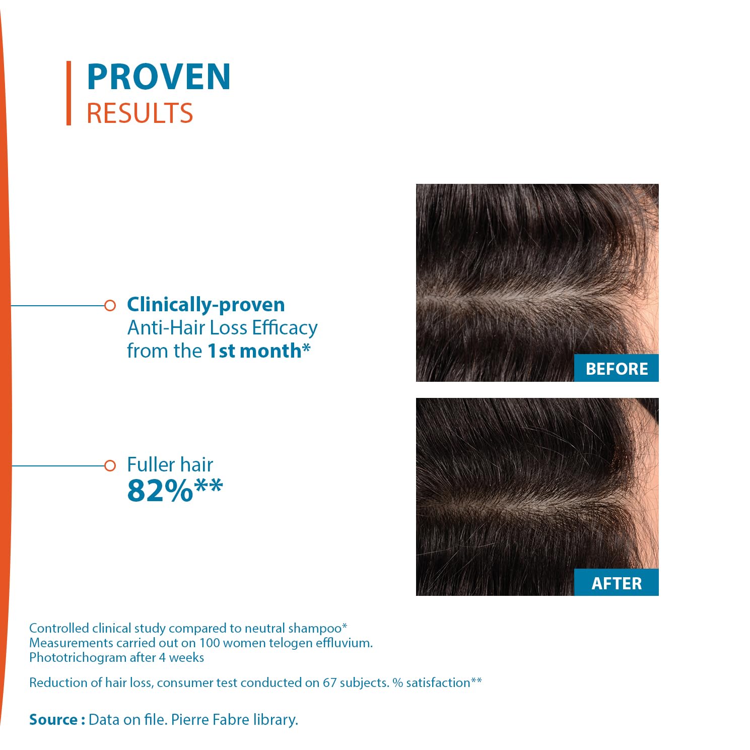 Ducray Creastim Reactiv used as part of daily scalp care routine