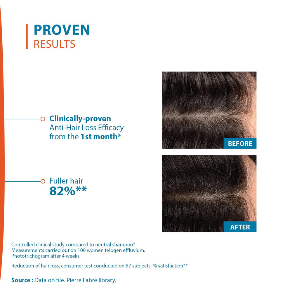 Ducray Creastim Reactiv used as part of daily scalp care routine