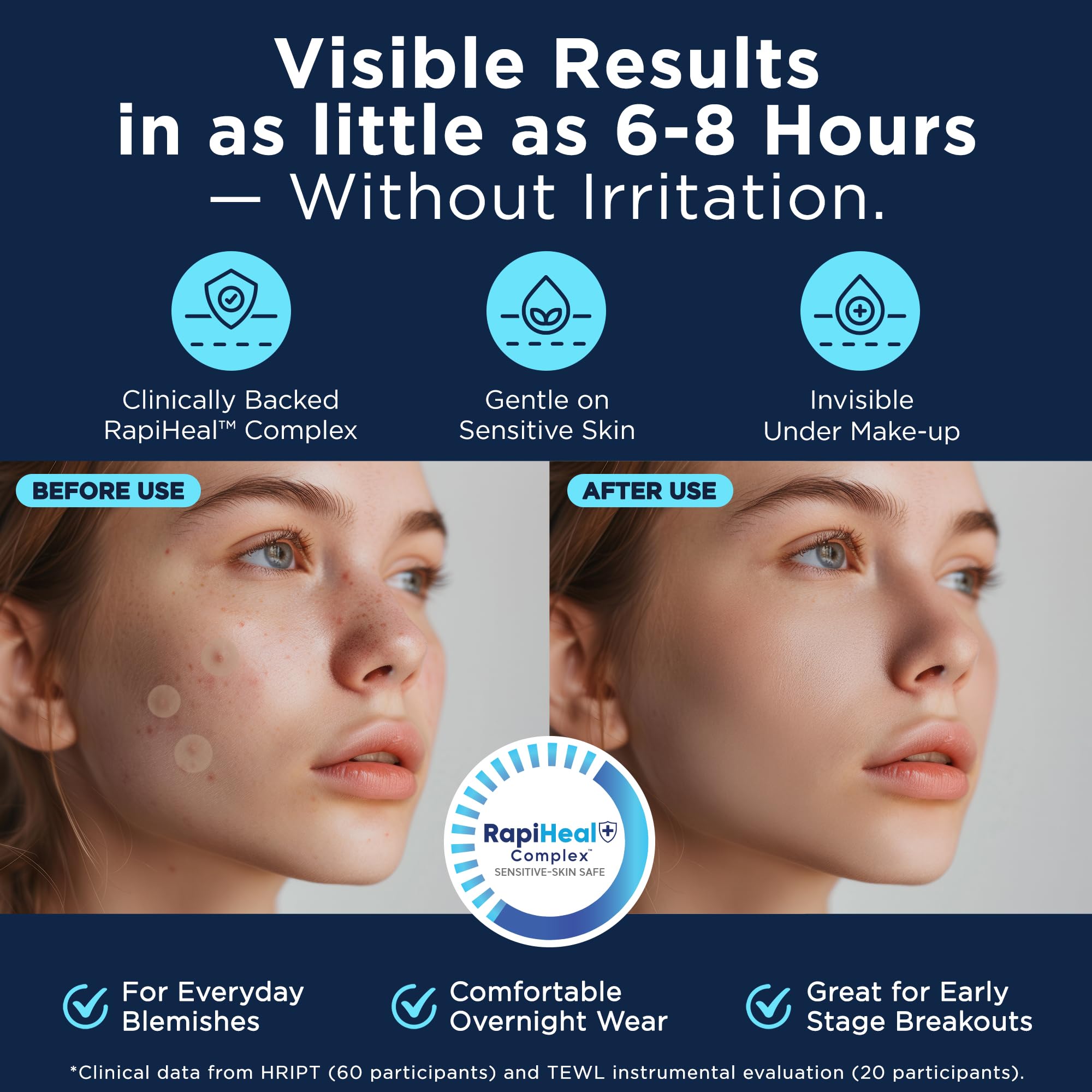 Dura Cleanse parches-acne-cara-tamano-grande: combate granos grandes sin irritar la piel.