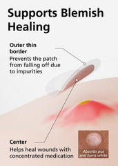 Parche 10 mm DWEasyDerm para zonas puntuales de la piel.