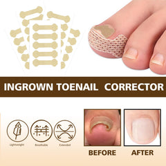 Dynaxor dual nail buffers rough filing and high-shine polishing improve adhesion