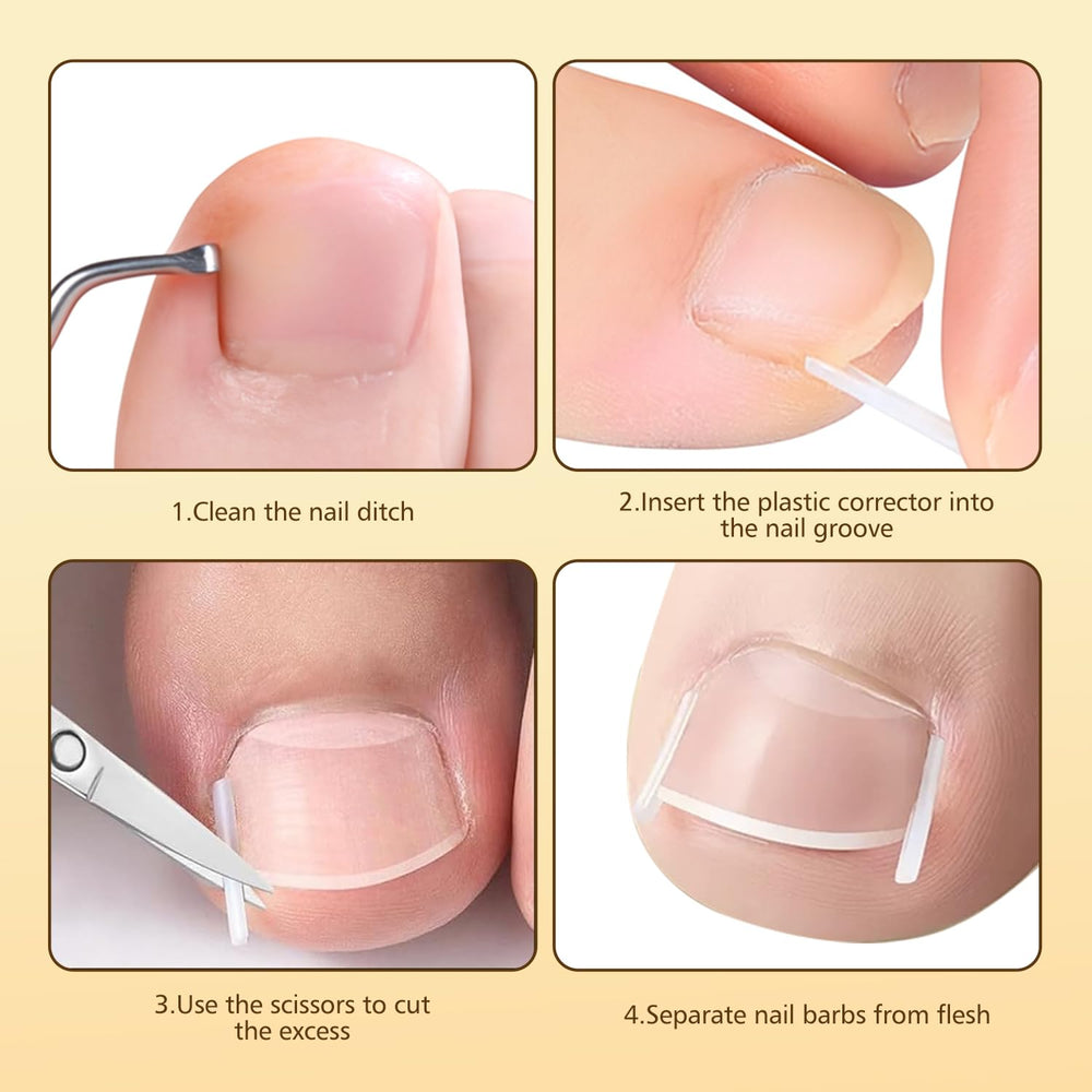 Dynaxor ingrown nail lifter tool helps lift edges for smoother shaping at home