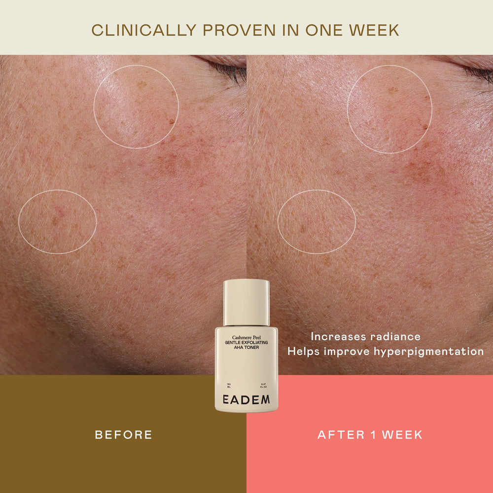EADEM Cashmere Peel application on face aids pore refinement and even tone