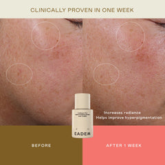 EADEM Cashmere Peel application on face aids pore refinement and even tone