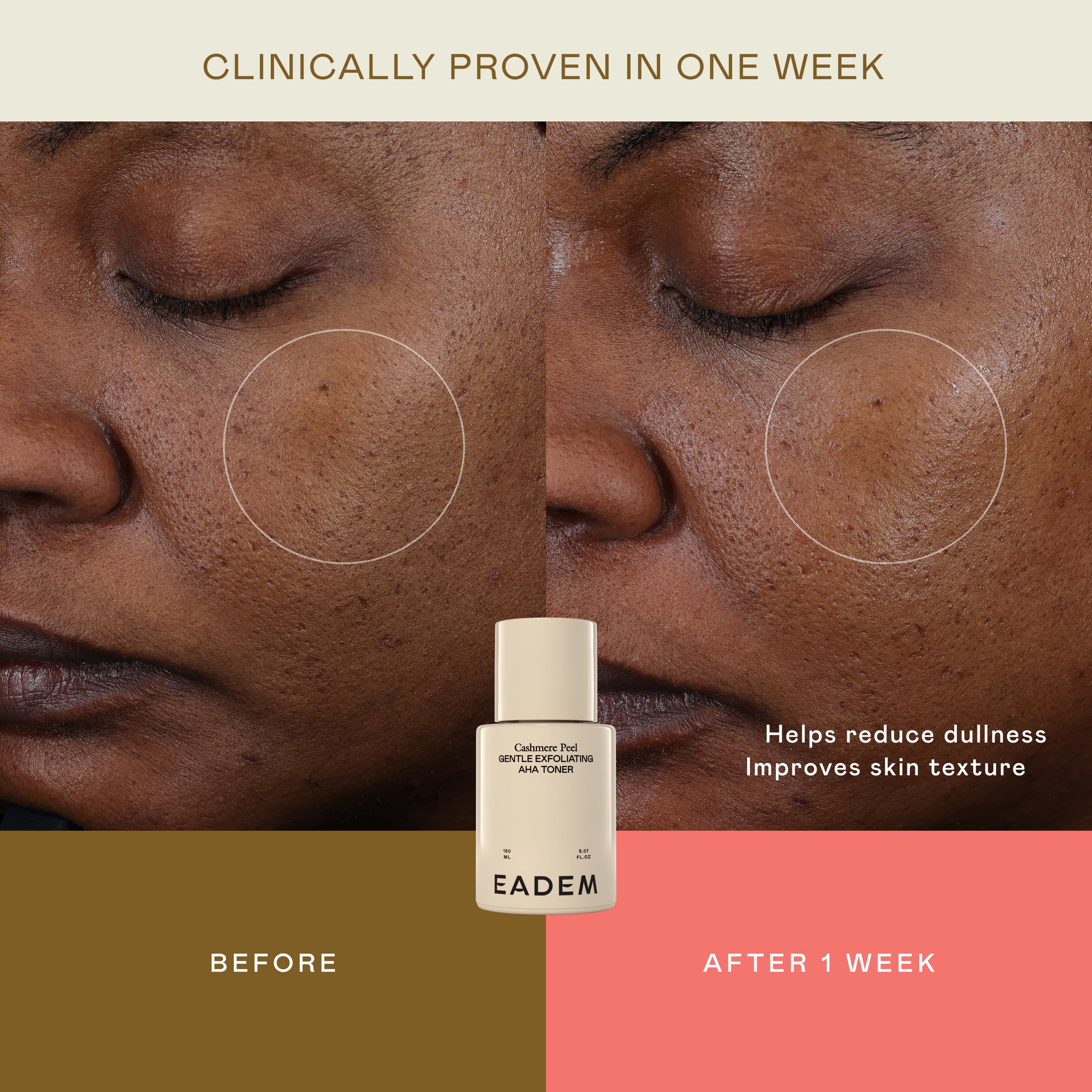 EADEM Cashmere Peel texture close-up highlights rice water hydration