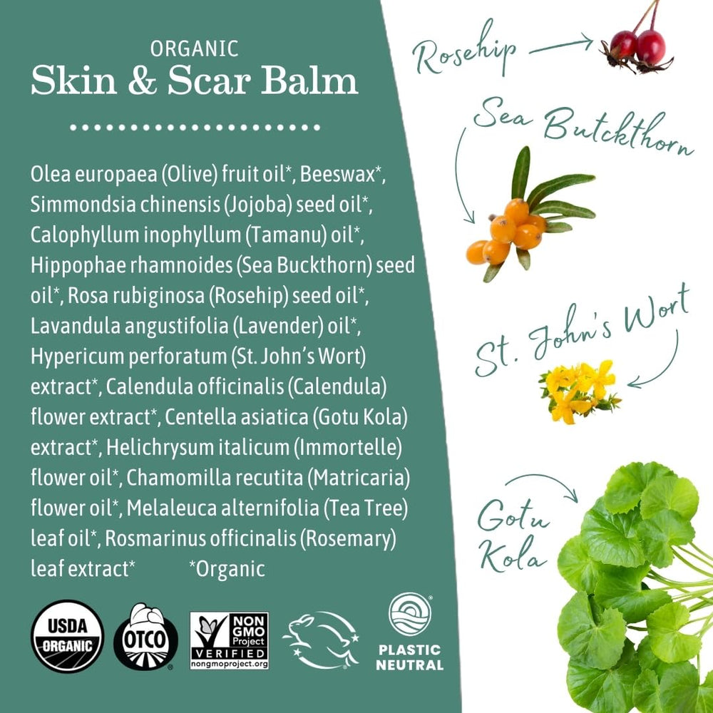 Earth Mama calendula ingredient offers soothing herbal calm