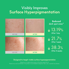 Niacinamide and Glutathione blend visual hints at even skin tone potential