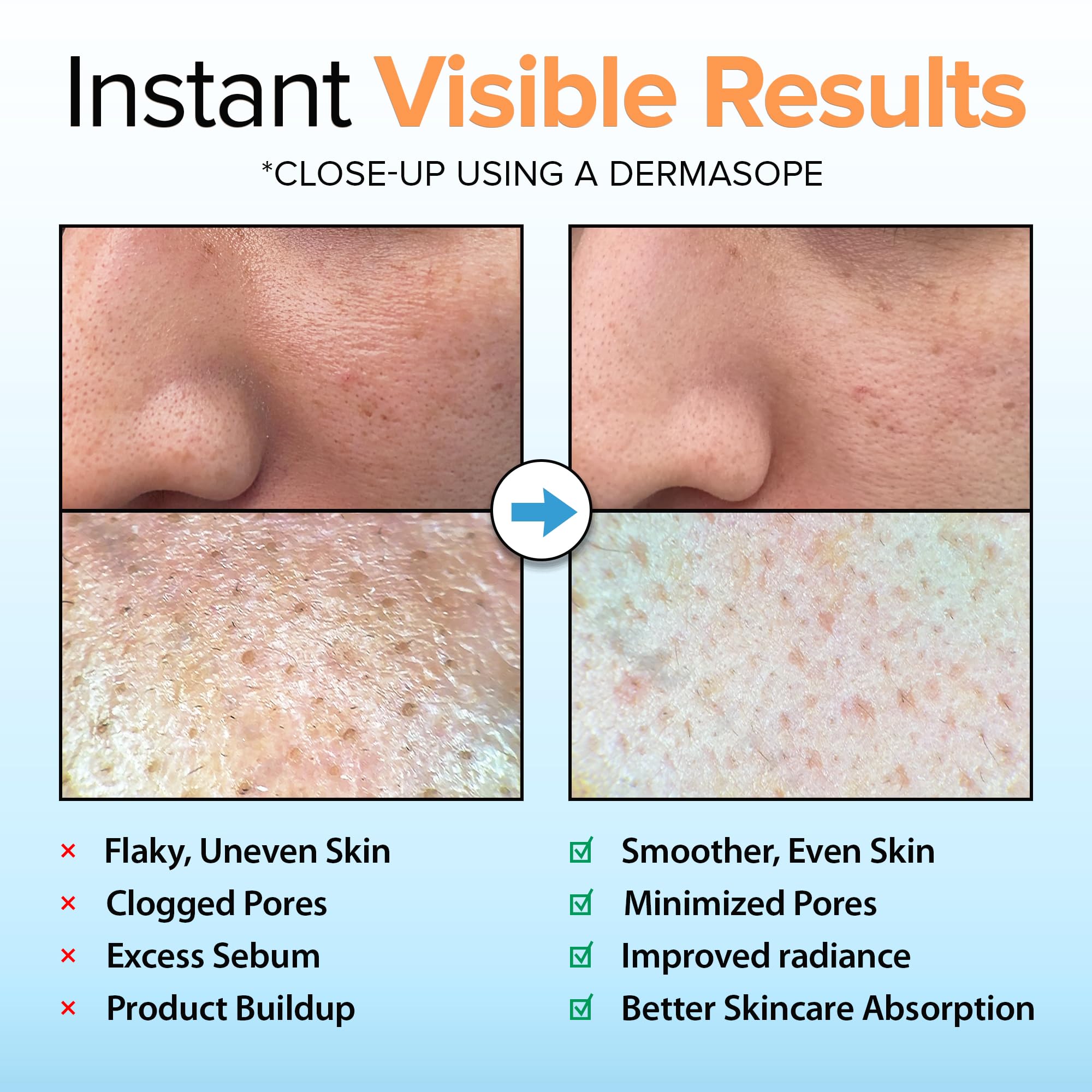 Ebanel gel exfoliante iluminador con vitamina C para tono uniforme en el rostro.
