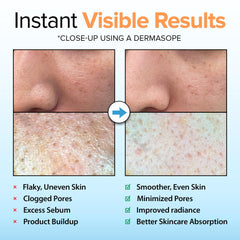 Ebanel gel exfoliante iluminador con vitamina C para tono uniforme en el rostro.
