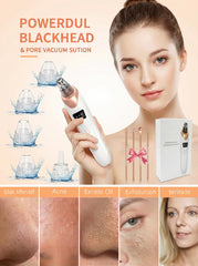 Echtur USB rechargeable pore vacuum ready for cordless skincare sessions