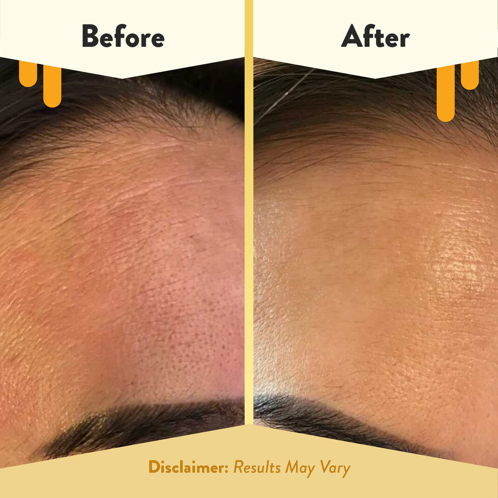 ECZEMA HONEY Nourishing Face Serum contains marula oil and oat extract