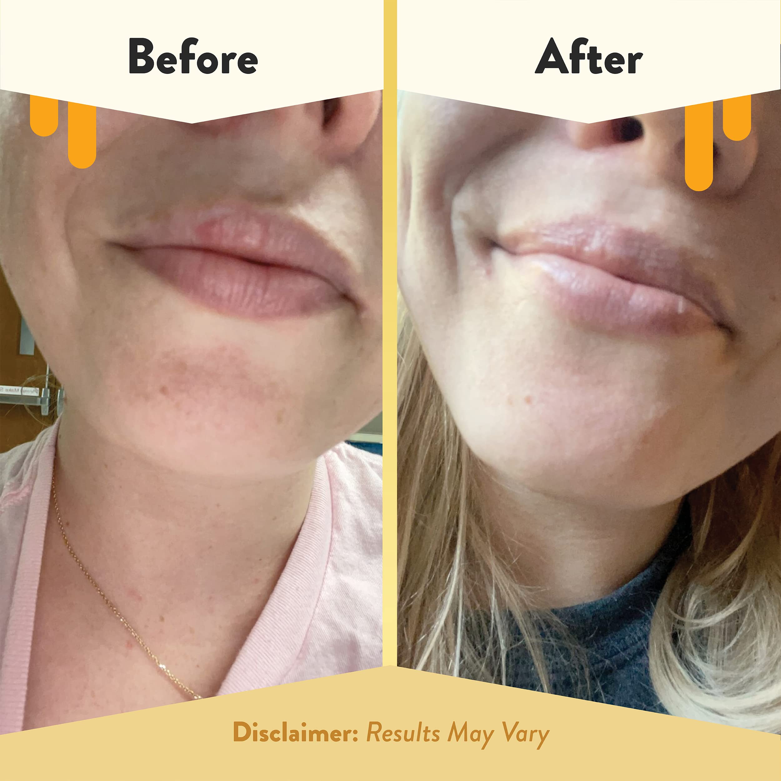 Mango butter and beeswax ingredients in Eczema Honey balm