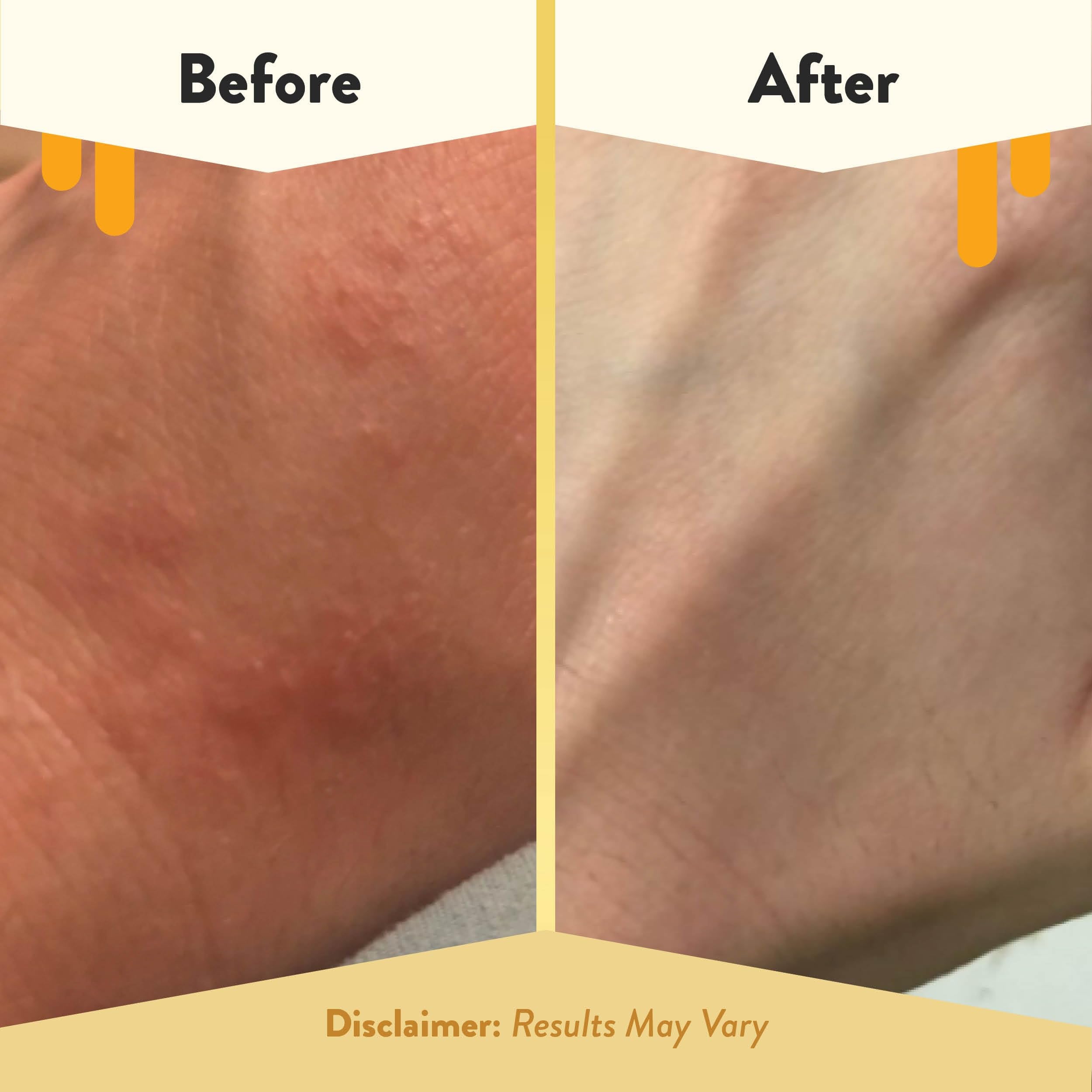 ECZEMA HONEY lotion ingredients label featuring aloe, honey, cocoa butter for sensitive skin