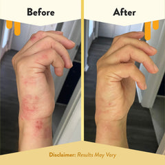 ECZEMA HONEY sin fragancias, ideal para pieles sensibles.