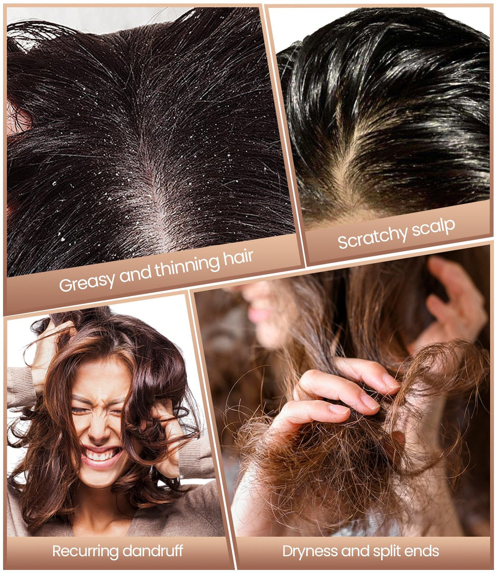Ehbelif Dandruff Comb travels easily in bags.