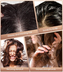Ehbelif Dandruff Comb travels easily in bags.