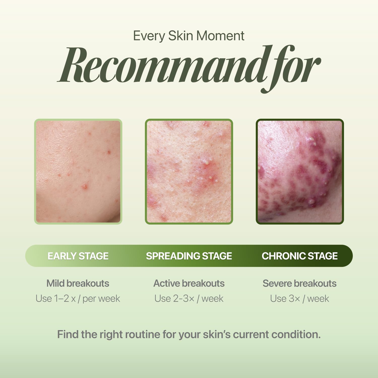 EIOM Trouble Patch Mask sheet texture supports quick application.